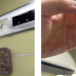 炎炎夏日 小心泌尿結石來敲門