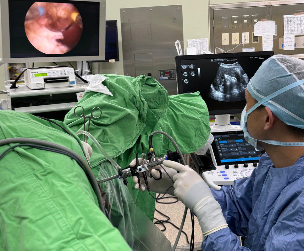 「精準子宮鏡肌腺組織減積術」告別子宮切除！李易良醫師為子宮肌腺症女性重啟希望