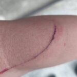 高雄男持鋼筆突襲　所長遭刺傷仍奮勇逮人法辦