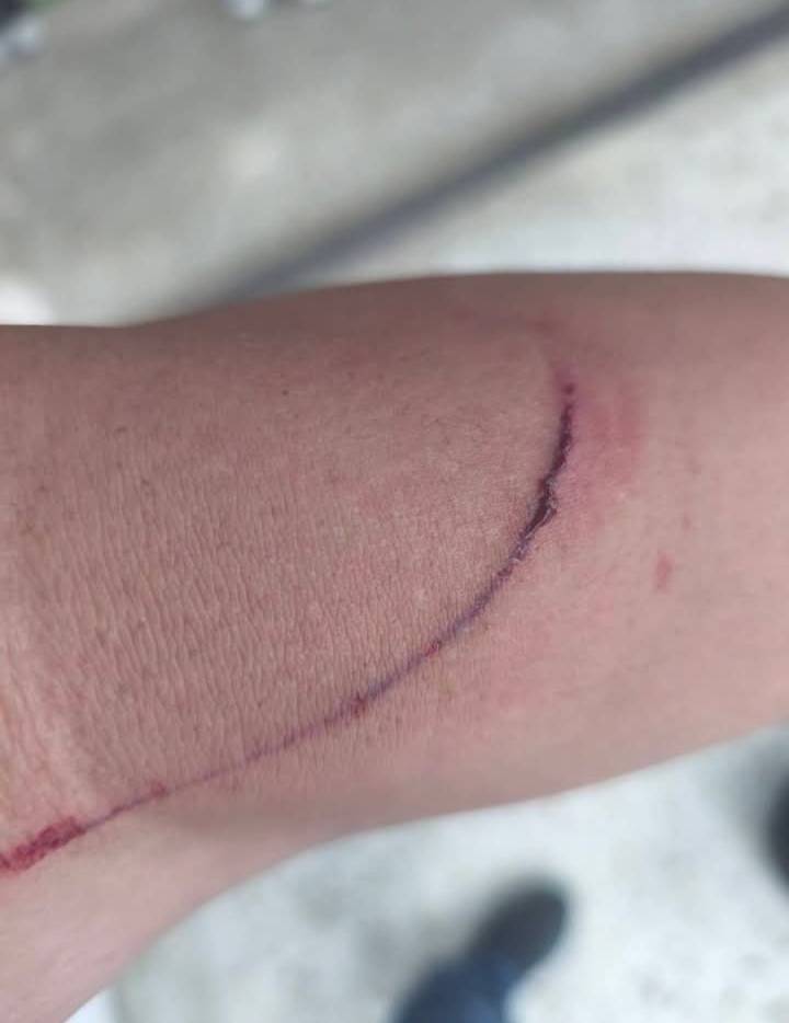 高雄男持鋼筆突襲　所長遭刺傷仍奮勇逮人法辦