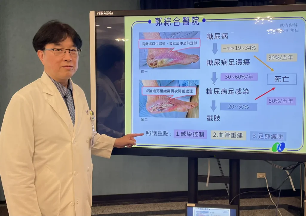 糖友”足部潰瘍傷口”不可輕忽-小心截肢及死亡風險